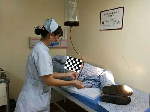 中药保留灌肠治疗肠炎