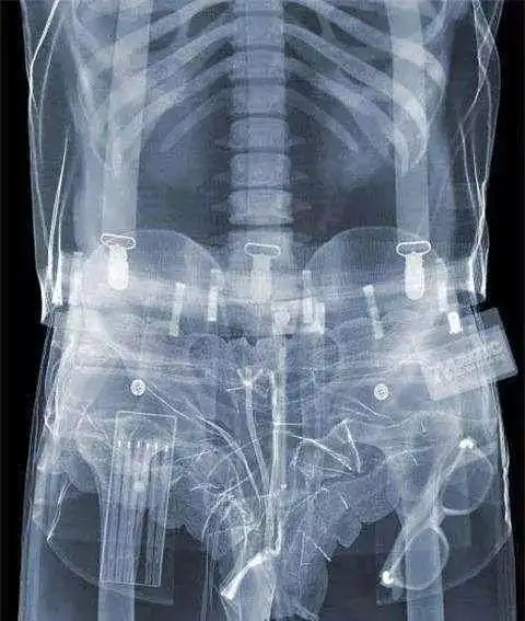 安检下的透视人!