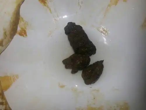 2014-06-14 高国静 医师 我姐得直肠癌便血已五个月现在吃中药自个月