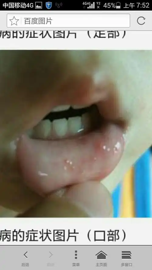 防治手足口,人人有责