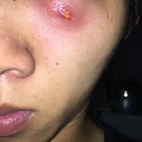 这是什么东西,中间的东西挤不出来,硬硬的一大块