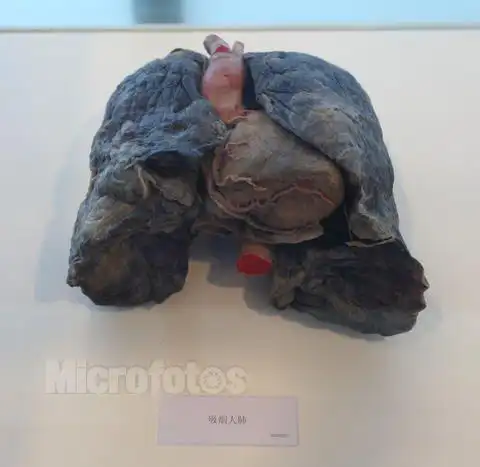 抽烟的肺