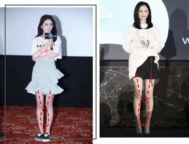 除了侧边运动裤 xo型 xo型腿的特点是脚尖脚跟可以并拢 但是小腿不能