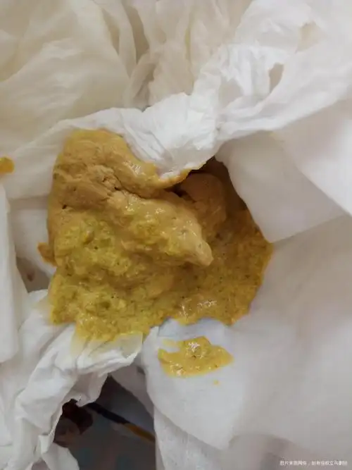 帮我看看宝宝得大便正不正常有图慎入