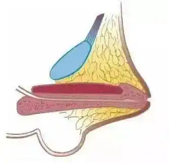 17岁大男孩的小鸡鸡像两三岁孩子这件事千万别忽视