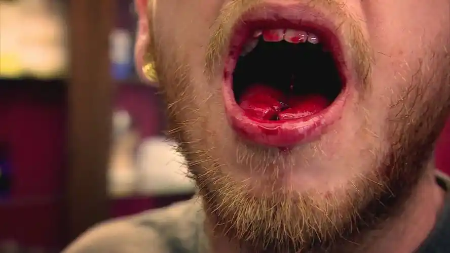 挑战重口味极限世界上恶心的人和事远超你的想象