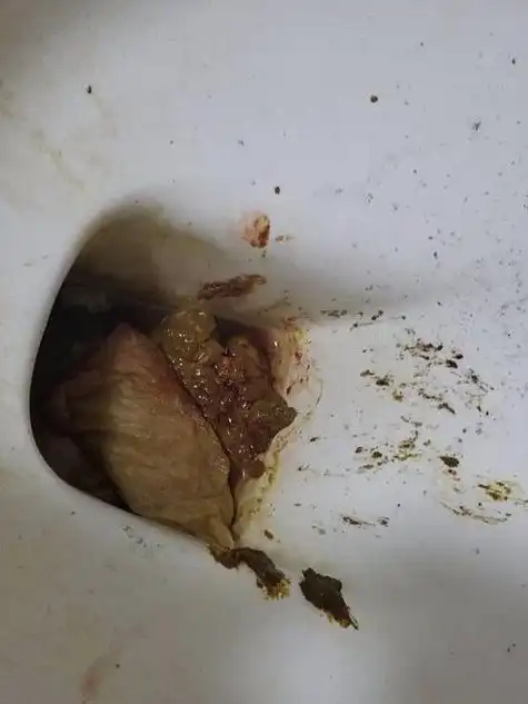 猫咪拉屎带血是怎么回事