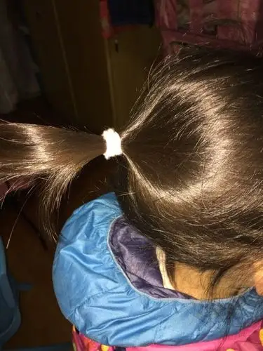 小女孩头发不好该不该给她剃光头