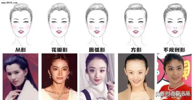 在线测发际线的形状