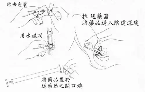 阴道栓剂正确使用须知