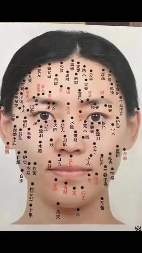 脸上长痣哪个位置好图解 脸上哪些痣不能去掉图-卜安居