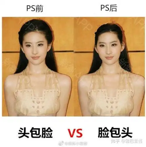 颧骨突出,太阳穴凹陷,就是脸包头头小显脸大.