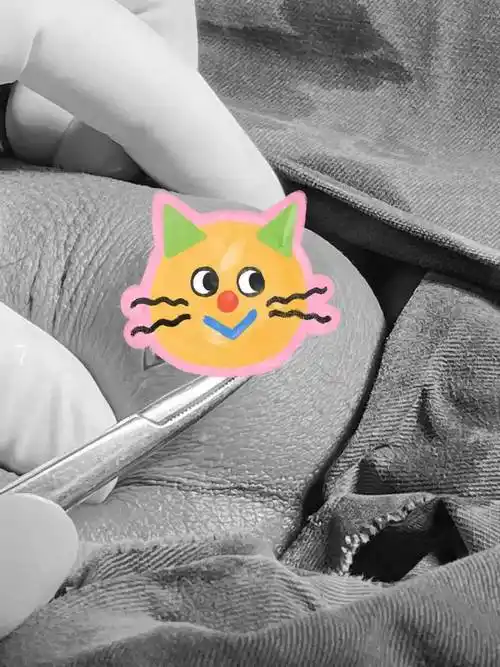 医疗技术孩子喊蛋疼家长要注意不要误了孩子一辈子