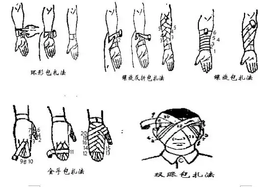 将三角巾折成约膝盖的宽度,盖住关节,保持内长外短,上边压上边,下边压
