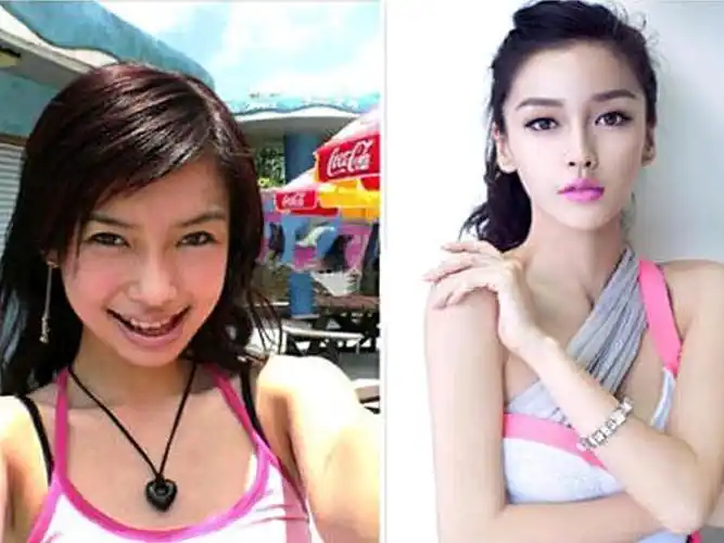 整容后变漂亮的女明星,猜猜第一名是哪位?