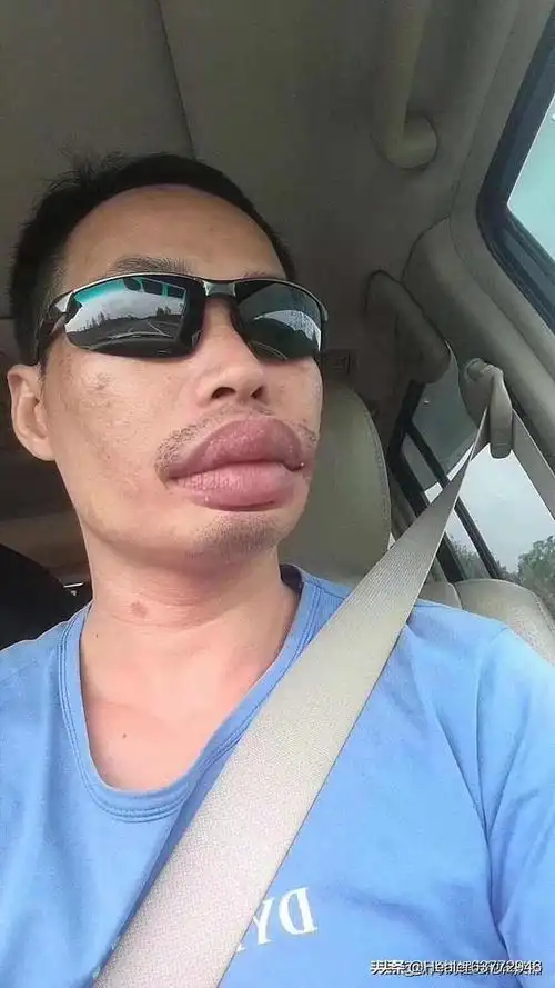 嘴唇厚的男人重感情_嘴唇厚的男人有福气吗