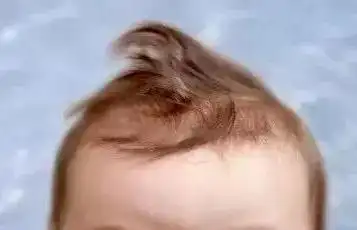 胎毛怎么处理-婴儿胎毛怎么处理比较好,剃有什么讲究-好运宝贝