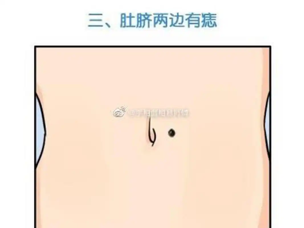 特殊一点的就是,肚脐眼上方有痣或者是长在肚脐的左边还是右边都属于