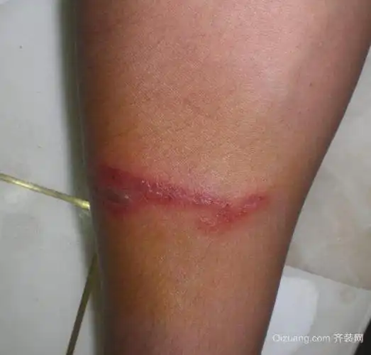 床虫是怎么产生的