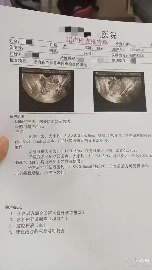 刚不久做的宫外孕,左边没保留了输卵管 还能用