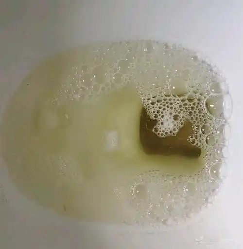 泡沫尿知多少请看下面