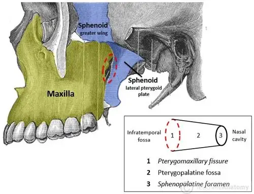 翼上颌裂(pterygomaxillary fissure)