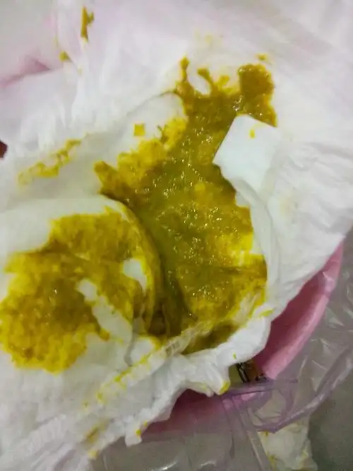 纯母乳拉这样正常吗?