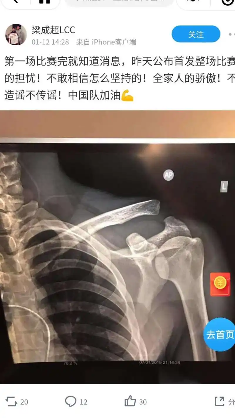 仍让"肩锁关节脱位三度"的武磊带伤征战,是利是弊?