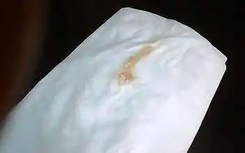 女性内裤上有这三种异常小心妇科病4种食物不要再碰了