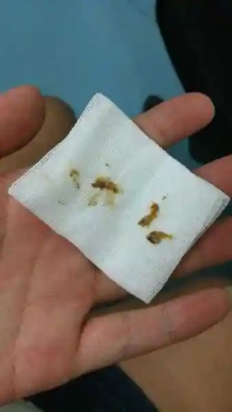 还有一个很难过的事实要告诉你, 就是油耳朵的人,一般属于遗传性狐臭