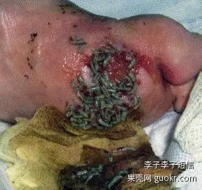 难以愈合的大型伤口的速度可能超过手术,例如糖尿病患者身上的伤口