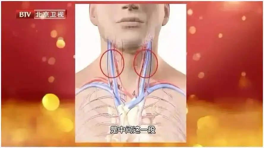 颈动脉在我们脖子两侧,全身的血液都会流经这里,相较于其他大动脉,颈