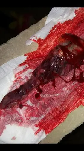 两个月的宝宝流产后是什么样的,请问我的是不是流产啊,是不是要成形了