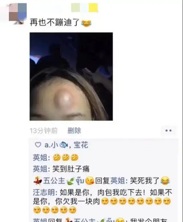 女子晚上去酒吧蹦迪太嗨了头上撞了个包23张搞笑动图哈哈