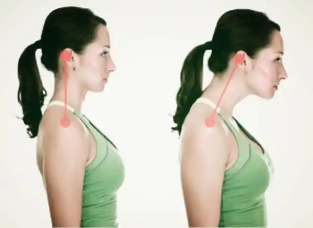 圆肩还有可能伴随着探颈,就是我们常说的头前倾.