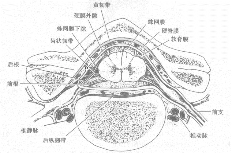 硬膜外间隙的位置[6] 所谓"硬膜外穿刺",就是把针打进硬脊膜和骨膜