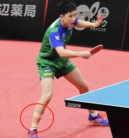 张本智和想成下一个马龙脚受伤坚持出战被轰111反获日本人心