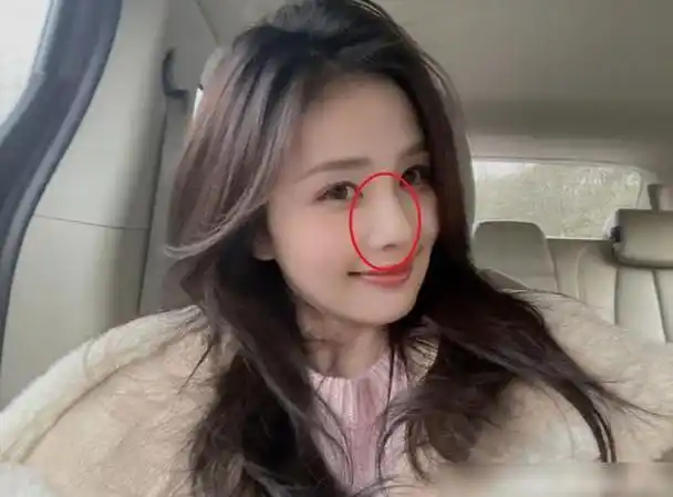 导语:作为一位备受瞩目的女明星,白鹿以其独特的长相和精妙的鼻子成为