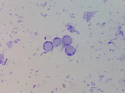 粪便中的人芽囊原虫图片欣赏