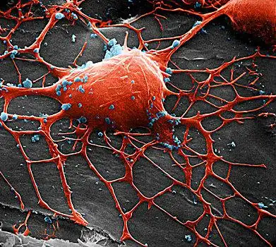 扫描,电子显微镜,形态,重要,局部,神经系统,神经,细胞,技能,分开