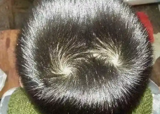 "双旋男孩找不到,双旋女孩没人要",孩子头上的旋有啥讲究