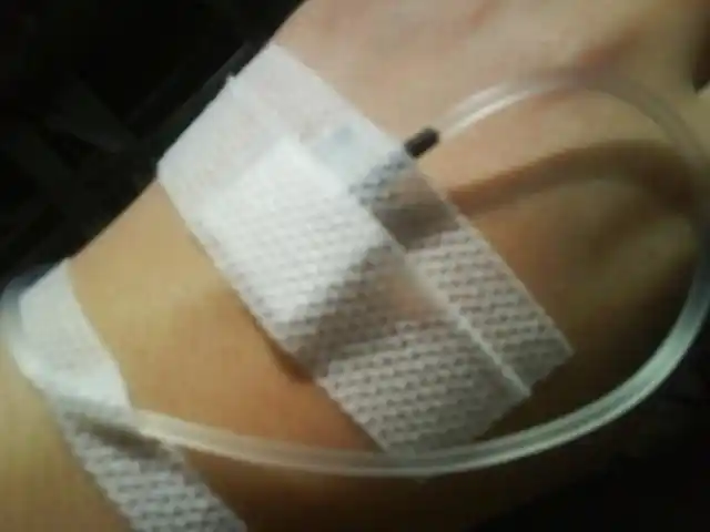 新人报道##自拍上瘾##我是女生##我是男生#换一只手继续输