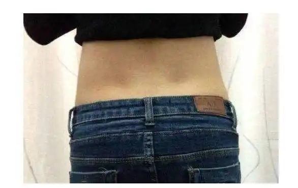 女性后腰上有两个凹点?有很多人都没有,有的人都是很有福气的!