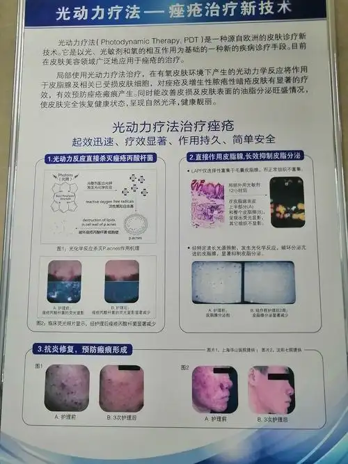 交大一附院学习皮肤科(1)