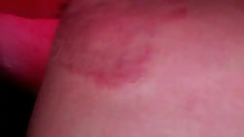 这是我在网上看到的一张图片,这是什么病啊?求知情的人回答!