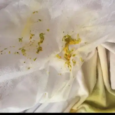 请问出生十天的宝宝最近解的大便是这种黄黄绿绿的小颗粒状的大便,是