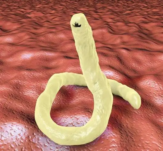 宝宝冬天有这3种表现,妈妈不能大意,说明宝宝肚子里有蛔虫了!