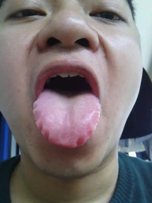 追问 男性,24岁.168cm,140斤,手脚冷热和舌质舌苔颜色我不会看.