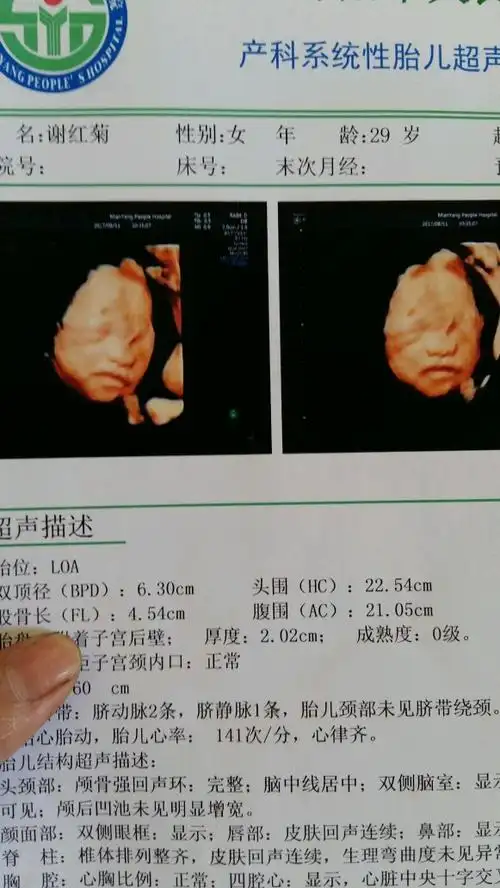 四维彩超,看看是娃还是女子