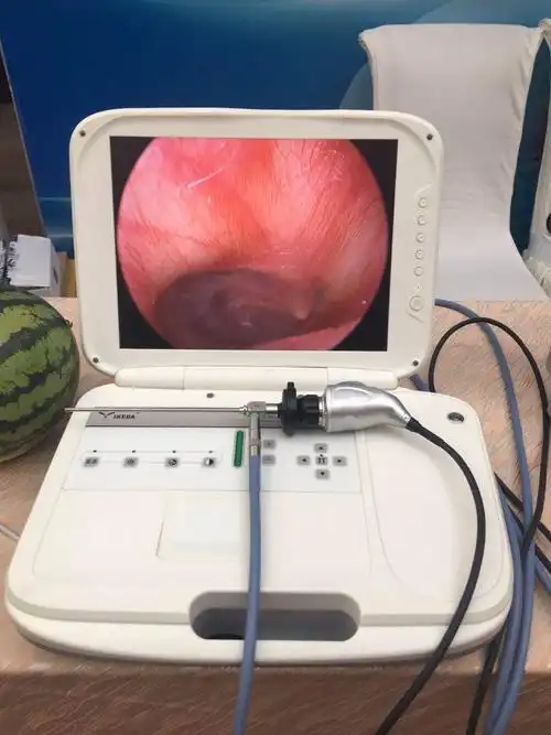 用于鼻外科手术的医用鼻镜内窥镜相机 - buy 内窥镜摄像机,鼻内窥镜